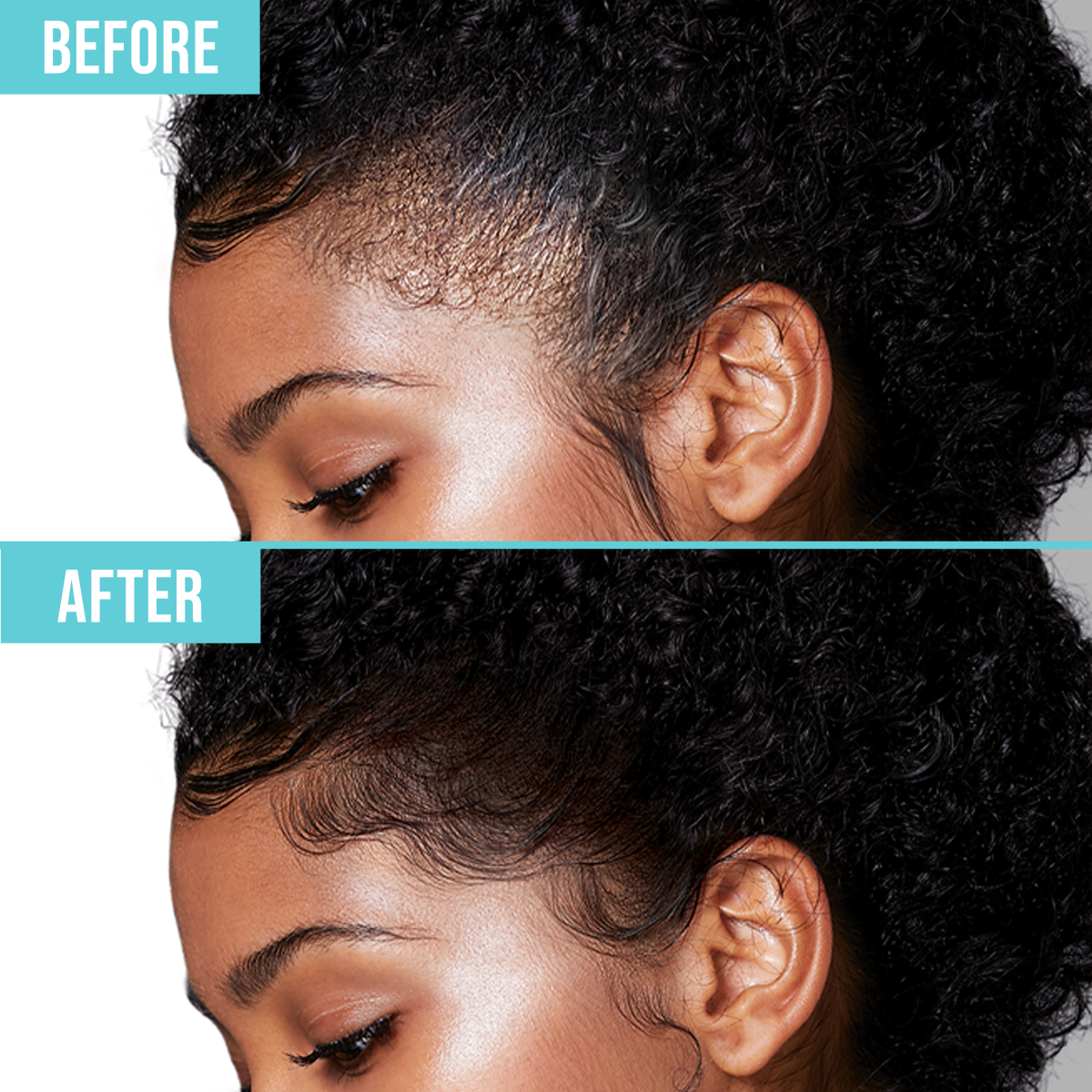 Close-up side profile of a woman’s forehead and ear showing before and after effects on hair edges; before shows natural, loose edges, after shows smooth, styled edges. Text reads “BEFORE” and “AFTER” in white on turquoise banners.