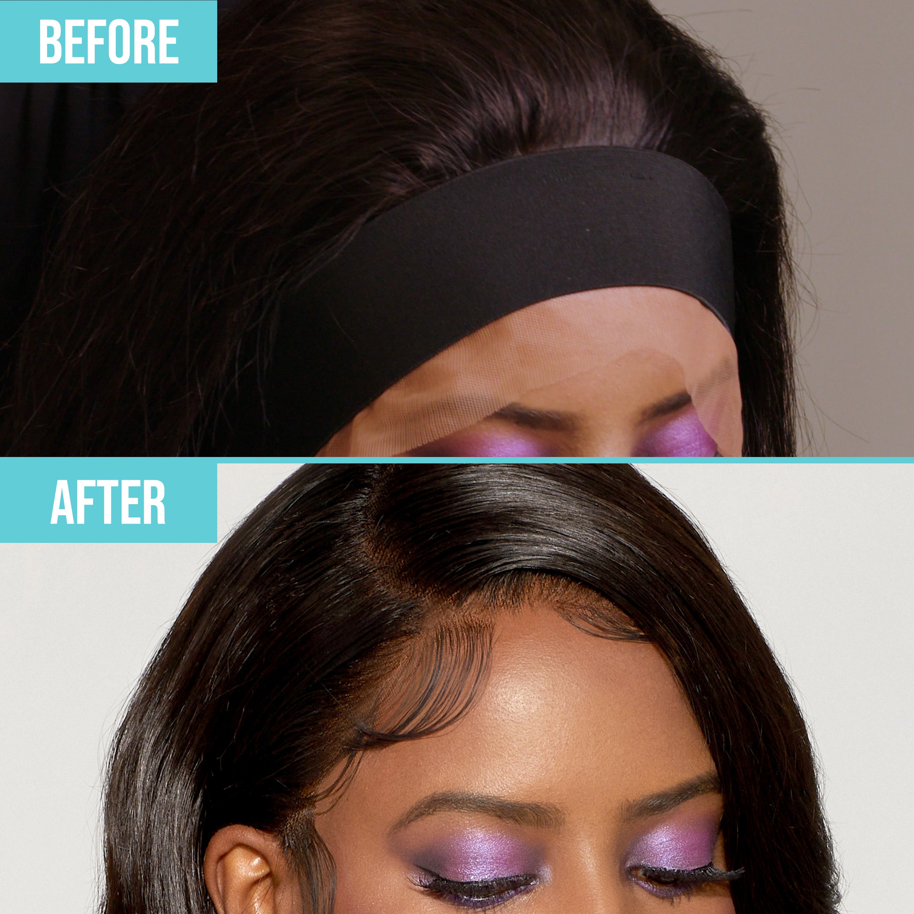 Before and after close-up comparison of a woman’s forehead and hairline, showing the removal of a black elastic band and lace front with a smooth, natural hairline styled with baby hairs; teal labels say \