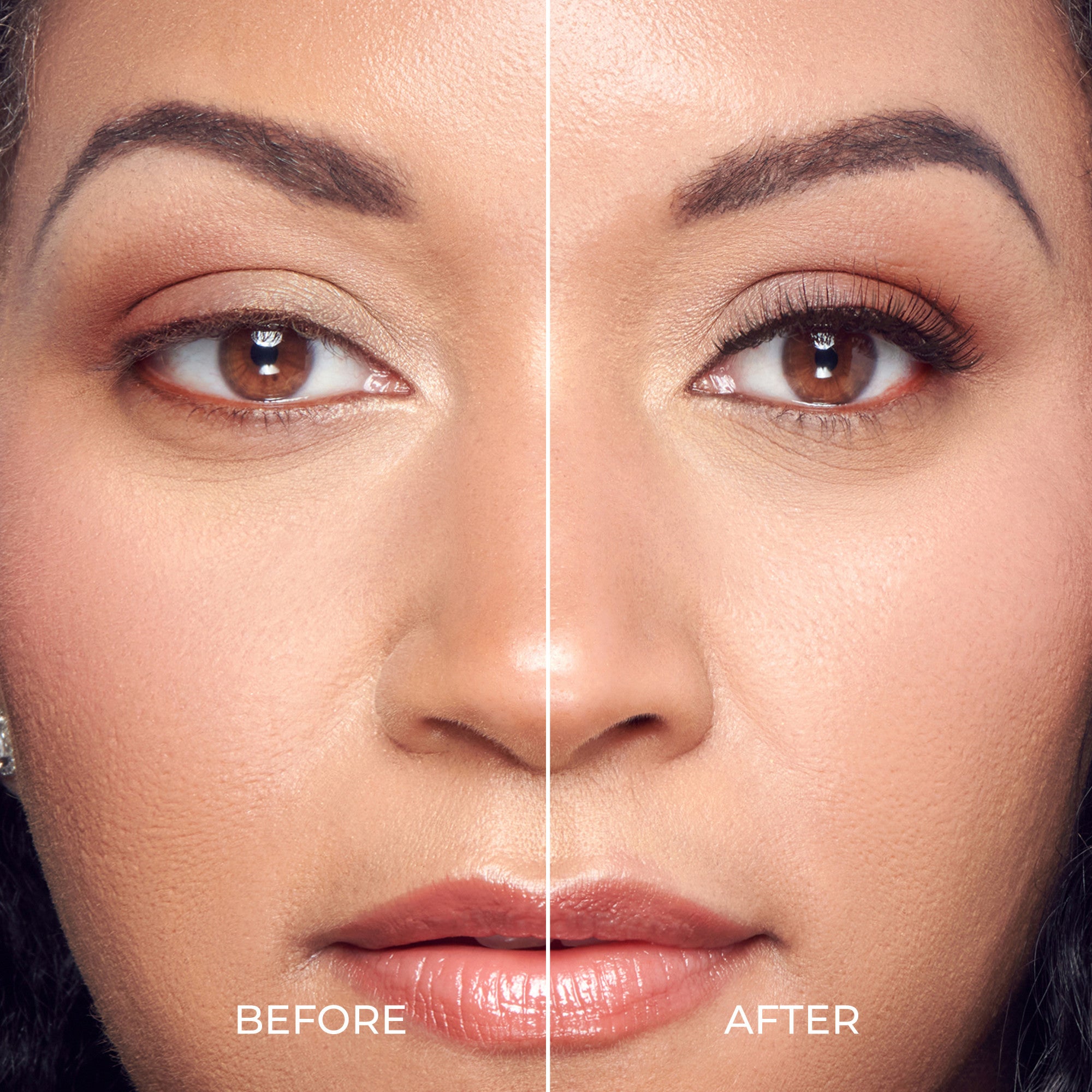 Before and after comparison of a woman&