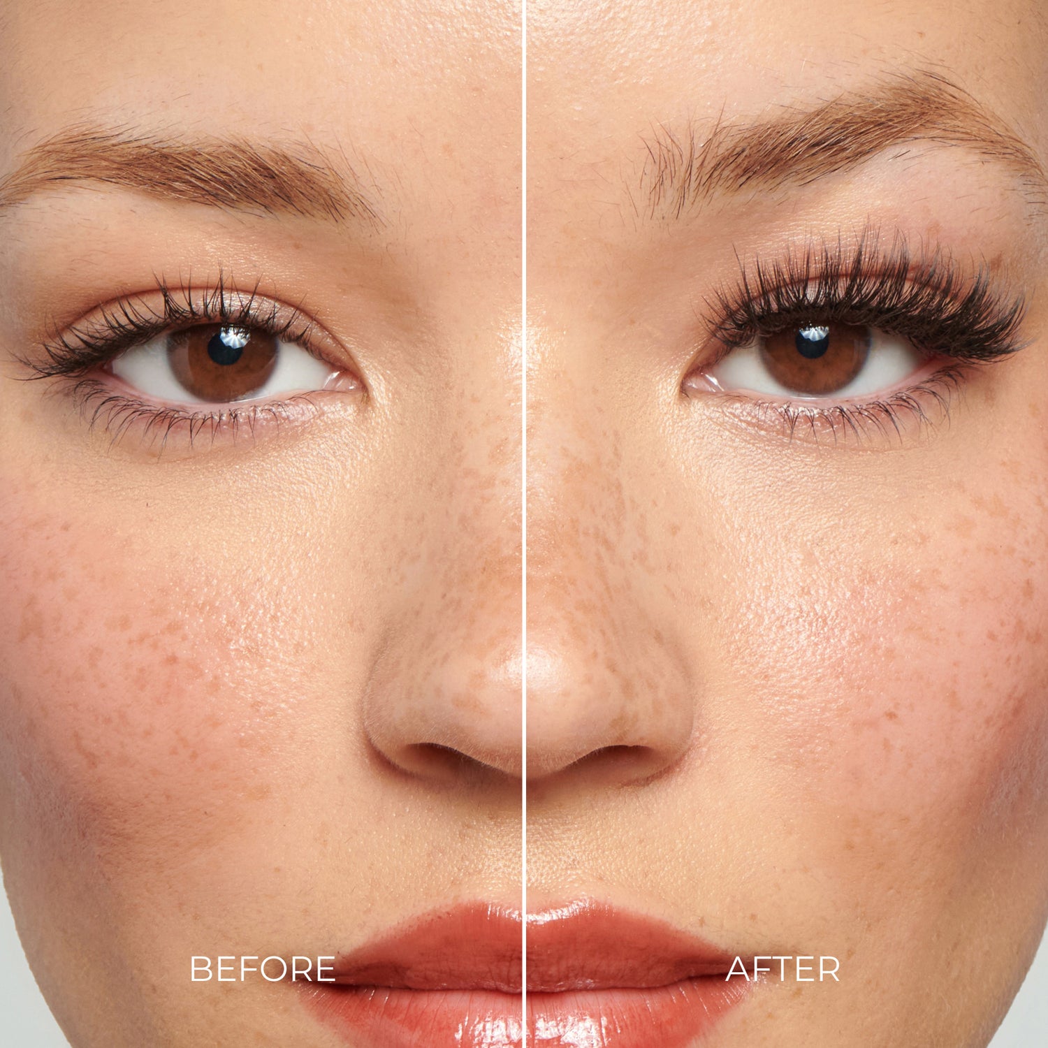 Before and after comparison of a woman&