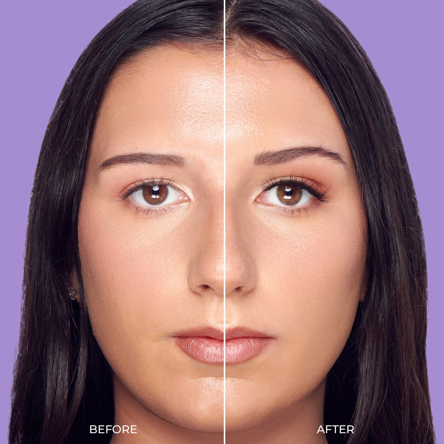 Before and after facial comparison showing skin texture and appearance changes against purple background.